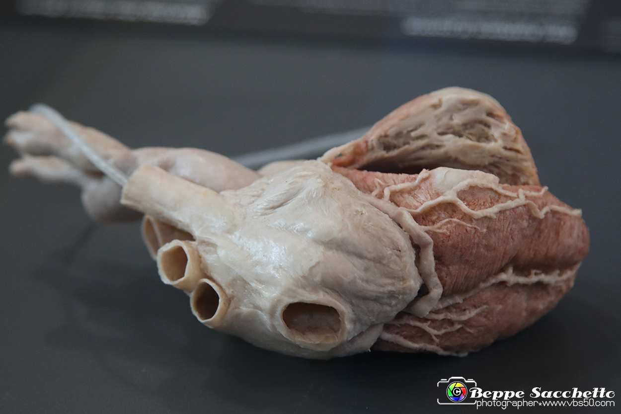 VBS_2852 - Cuore - Mostra Body Worlds.jpg